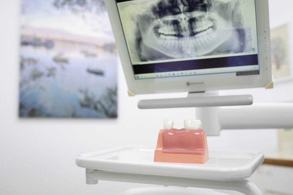 Replacing missing teeth at Richmond Road Dental
