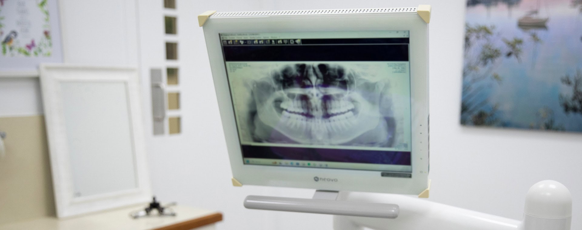 Digital x-rays at Richmond Road Dental