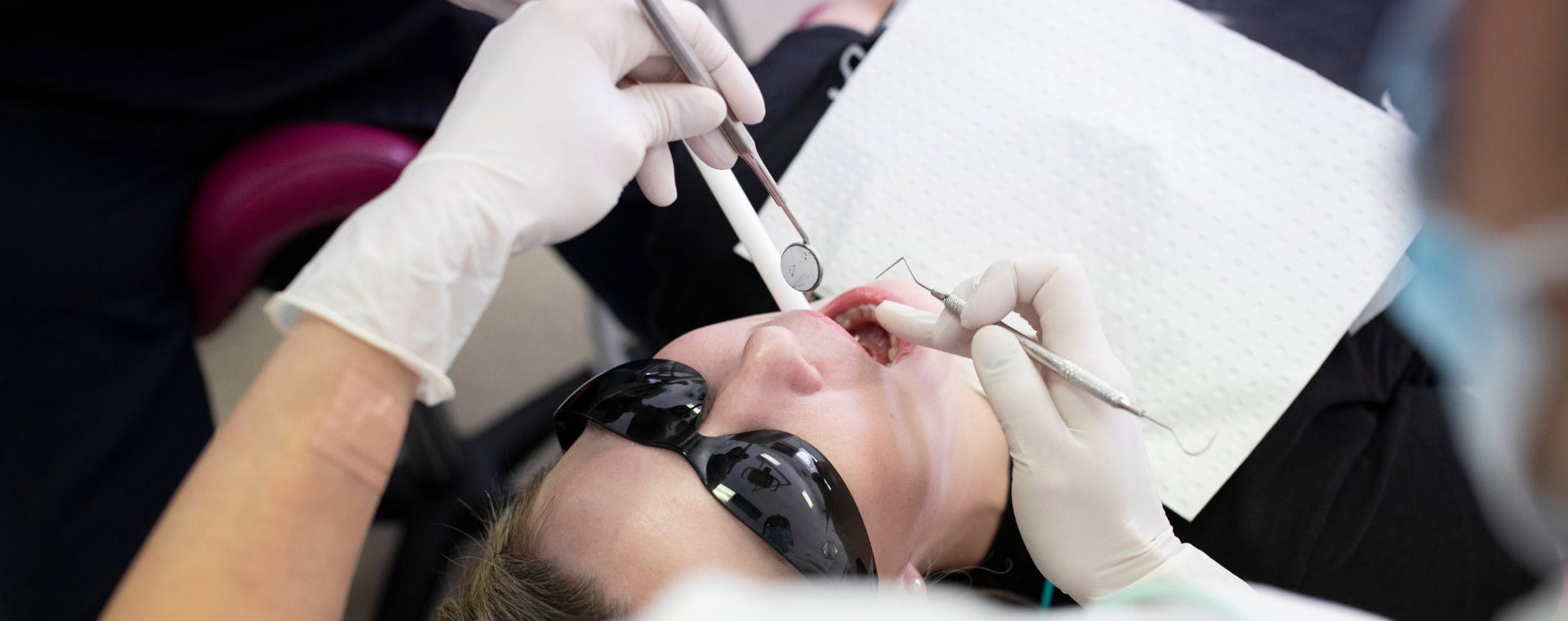 Fissure sealants at Richmond Road Dental