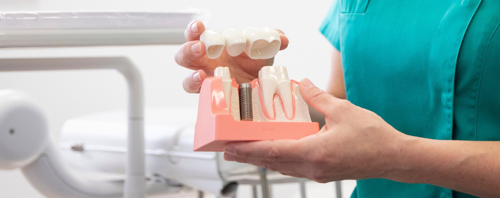 Dental bridges at Richmond Road Dental